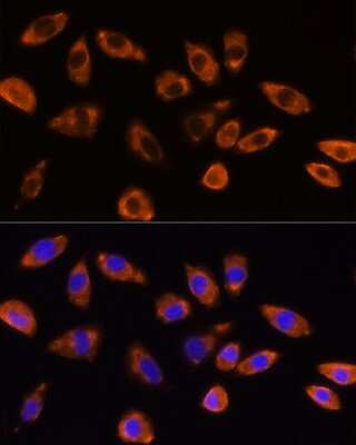 Immunocytochemistry/ Immunofluorescence: GNB1 Antibody - BSA Free [NBP3-04689]