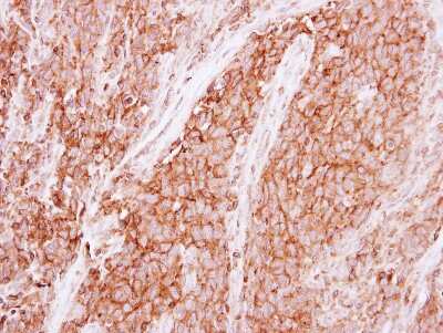 Immunohistochemistry-Paraffin: GNB1 Antibody [NBP2-16699]