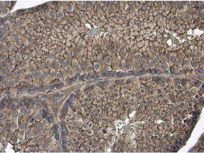 Immunohistochemistry-Paraffin: GNB1 Antibody [NBP2-16699]