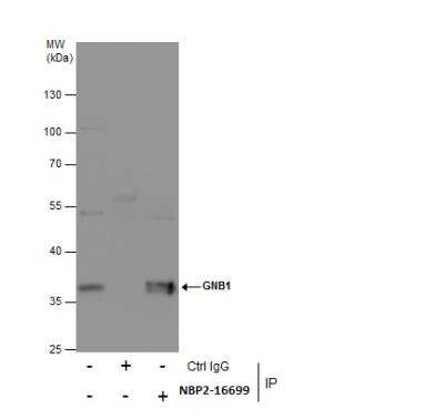 Immunoprecipitation: GNB1 Antibody [NBP2-16699]