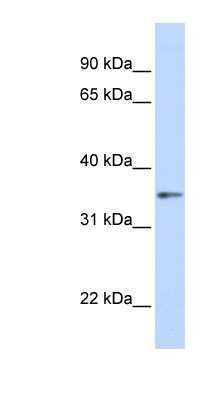 Western Blot: GNB1 Antibody [NBP1-55308]