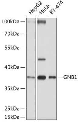 Western Blot: GNB1 AntibodyBSA Free [NBP3-04689]