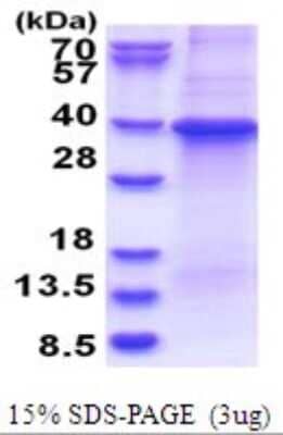 SDS-PAGE: Recombinant Human GNB1 His Protein [NBP2-51678]