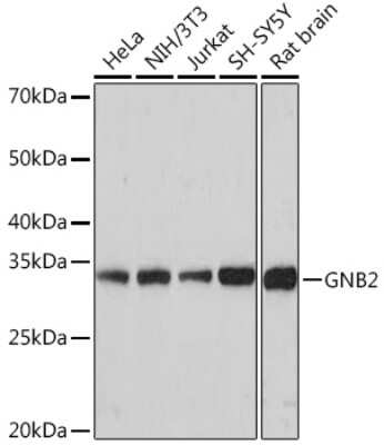 Western Blot: GNB2 Antibody (6U9B3) [NBP3-16846]