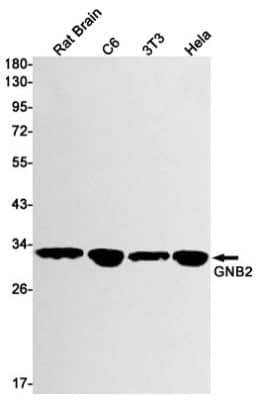 Western Blot: GNB2 Antibody (S04-1A2) [NBP3-19495]