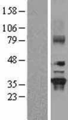 Western Blot: GNB2 Overexpression Lysate [NBL1-11165]