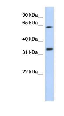 Western Blot: RACK1/GNB2L1 Antibody [NBP1-58959]