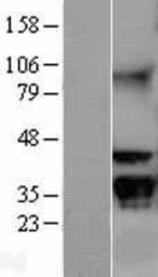 Western Blot: RACK1/GNB2L1 Overexpression Lysate [NBL1-11166]