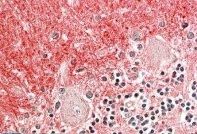 Immunohistochemistry-Paraffin: GNB3 Antibody [NBP1-52107]