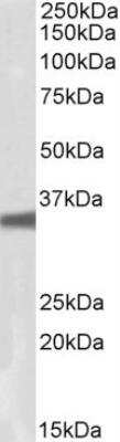 Western Blot: GNB3 Antibody [NBP1-52107]