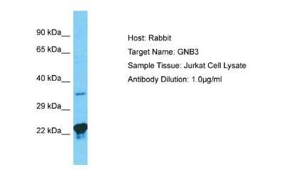 Western Blot: GNB3 Antibody [NBP2-82240]