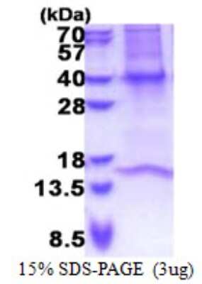 SDS-PAGE: Recombinant Human GNB3 His Protein [NBP2-23096]