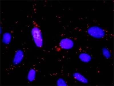 Proximity Ligation Assay: GNB5 Antibody (3A3) [H00010681-M01]