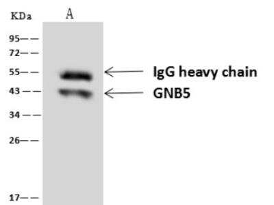 Immunoprecipitation: GNB5 Antibody [NBP3-06495]