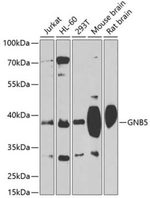 Western Blot: GNB5 AntibodyBSA Free [NBP3-04505]