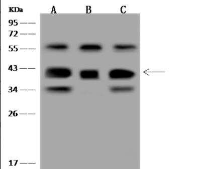 Western Blot: GNB5 Antibody [NBP3-06495]