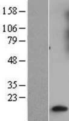 Western Blot: GNG10 Overexpression Lysate [NBL1-11170]