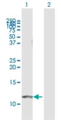 Western Blot: GNG11 Antibody [H00002791-B01P]