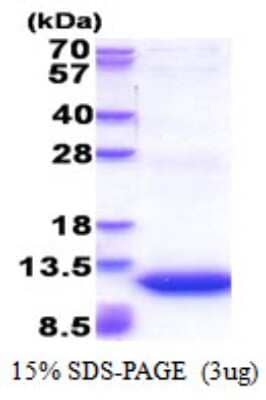 SDS-PAGE: Recombinant Human GNG11 His Protein [NBP2-51549]