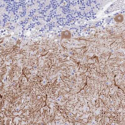 Immunohistochemistry-Paraffin: GNG13 Antibody [NBP1-91950]