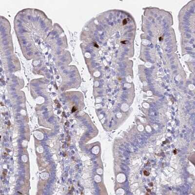 Immunohistochemistry-Paraffin: GNG13 Antibody [NBP1-91950]