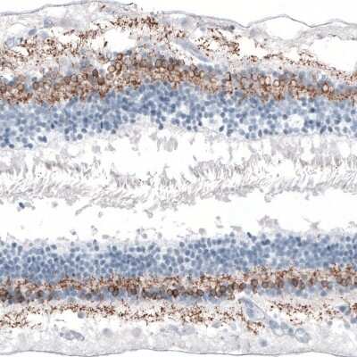 Immunohistochemistry-Paraffin: GNG13 Antibody [NBP1-91950]