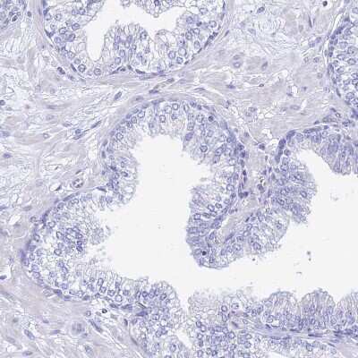 Immunohistochemistry-Paraffin: GNG13 Antibody [NBP1-91950]