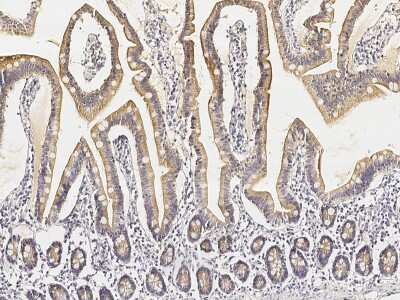 Immunohistochemistry-Paraffin: GNG13 Antibody [NBP3-00086]