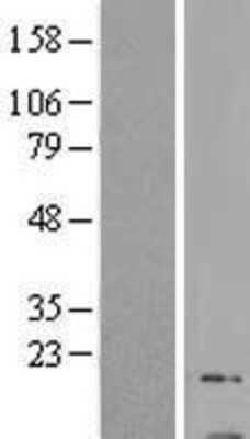 Western Blot: GNG13 Overexpression Lysate [NBL1-11173]