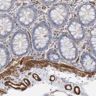 Immunohistochemistry-Paraffin: GNG2 Antibody [NBP1-86156]
