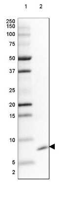 Western Blot: GNG5 Antibody [NBP2-14061]