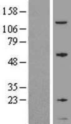 Western Blot: GNG5 Overexpression Lysate [NBL1-11176]