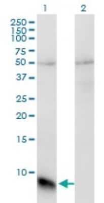 Western Blot: GNGT1 Antibody (1F8) [H00002792-M01]