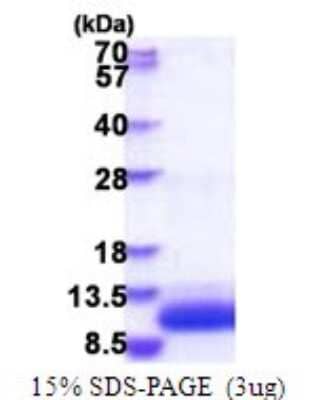 SDS-PAGE: Recombinant Human GNGT1 His Protein [NBP2-51827]