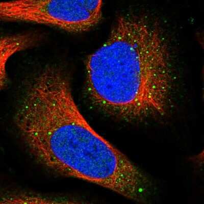 Immunocytochemistry/ Immunofluorescence: GNIP Antibody [NBP1-89751]