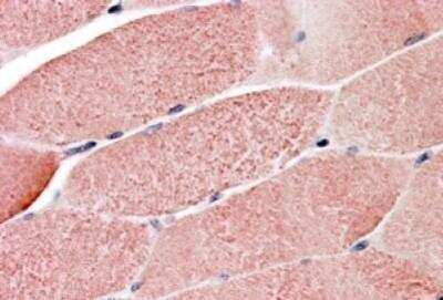 Immunohistochemistry-Paraffin: GNIP Antibody [NB100-1229]