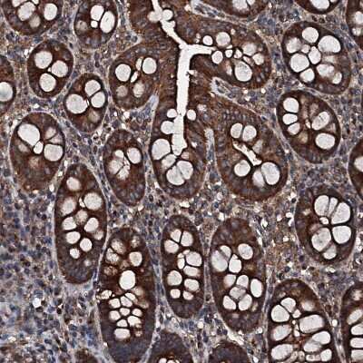 Immunohistochemistry-Paraffin: GNIP Antibody [NBP1-89751]