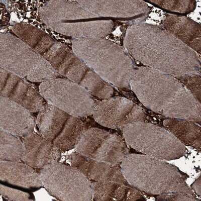 Immunohistochemistry-Paraffin: GNIP Antibody [NBP1-89751]