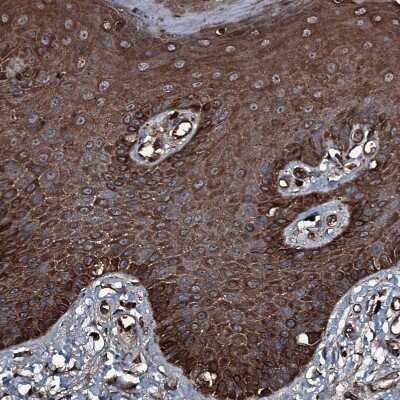 Immunohistochemistry-Paraffin: GNIP Antibody [NBP1-89751]