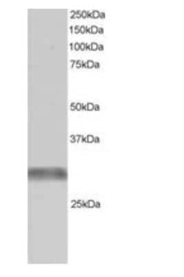 Western Blot: GNIP Antibody [NB100-1229]