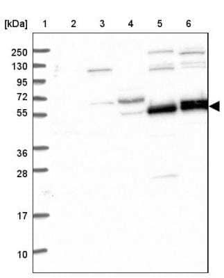 Western Blot: GNIP Antibody [NBP1-89751]