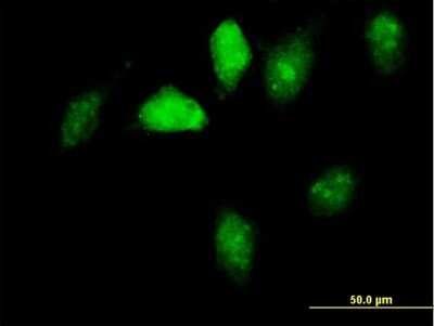 Immunocytochemistry/ Immunofluorescence: GNL1 Antibody [H00002794-B01P]