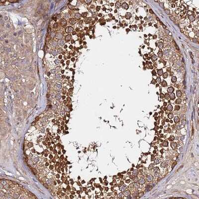 Immunohistochemistry-Paraffin: GNL1 Antibody [NBP2-14062]