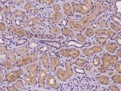 Immunohistochemistry-Paraffin: GNL1 Antibody [NBP2-98026]