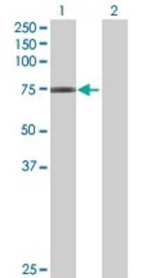 Western Blot: GNL1 Antibody [H00002794-B01P]