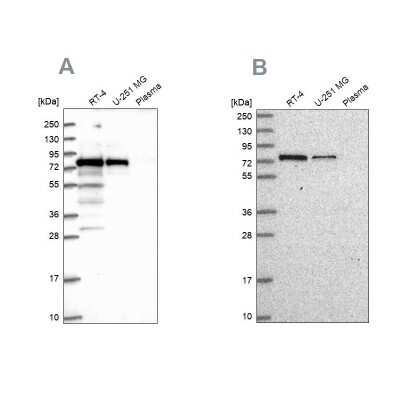 Western Blot: GNL1 Antibody [NBP2-14062]