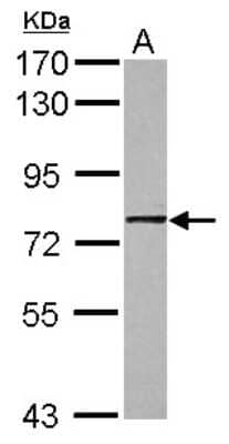 Western Blot: GNL1 Antibody [NBP2-16701]