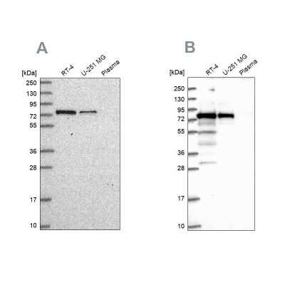 Western Blot: GNL1 Antibody [NBP2-54938]