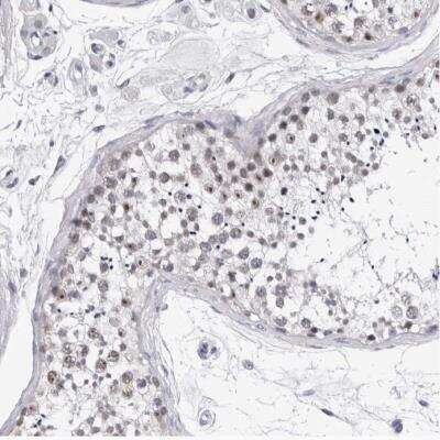 Immunohistochemistry-Paraffin: GNL2 Antibody [NBP1-81649]