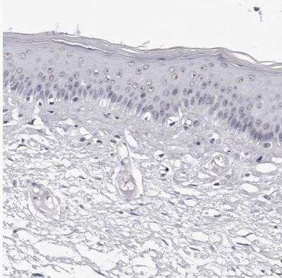 Immunohistochemistry-Paraffin: GNL2 Antibody [NBP1-81649]